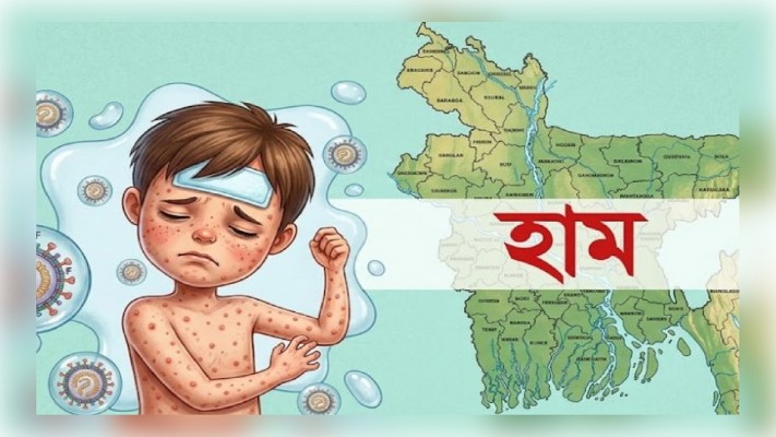 গত ২৪ ঘণ্টায় হামের উপসর্গে আরও ৮ জনের মৃত্যু
